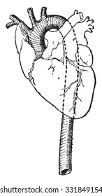 Aorta, vintage engraved illustration. Dictionary of words and things - Larive and Fleury - 1895.