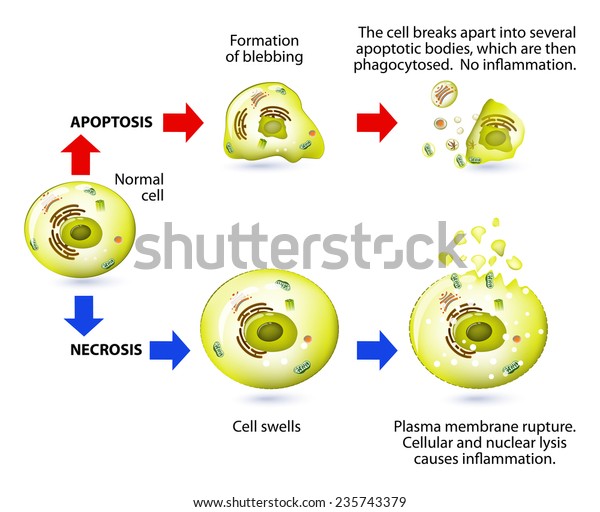 アポトーシスと壊死は細胞死の一種である 壊死またはアポトーシスを受ける細胞の構造変化 アポトーシスと壊死の過程の回路図表現 のベクター画像素材 ロイヤリティフリー
