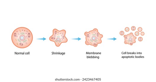 Apoptosis. Programmed cell death. Aging process in cells. Stages of apoptosis, normal cell, shrinkage, membrane blebbing, cell breaks into apoptotic bodies and phagocytosis. vector illustration.