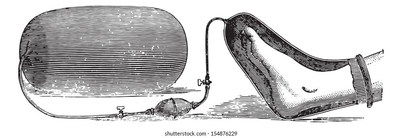An apparatus for the application of oxygen on a limb gangrene, vintage engraved illustration. Usual Medicine Dictionary - Paul Labarthe - 1885.