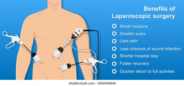 appendectomy medical surgery organ colon tool heal room body doctor pain scars liver cancer tummy tumor mass trocars nurse pelvic video health system display urology monitor endoscopic cholecystitis