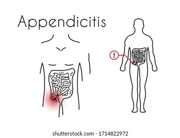 Appendicitis linear icon. Vector minimal illustration of young man with red spot on his tummy suffers from inflammation of the appendix. Design template for medicine or therapy for appendicitis.