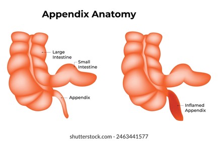 Appendix Anatomy Science Design Vector Illustration Diagram