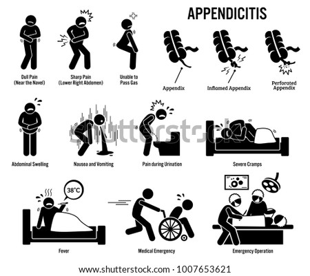 Appendix and Appendicitis Icons. Pictogram and diagrams depict signs, symptoms, and emergency surgery of a appendicitis patient in surgery room. 