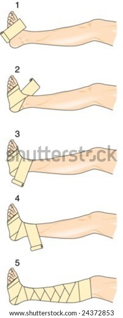 Application Figure Eight Bandage Stock Vector Royalty Free 24372853