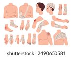 Applying bandages to wounds. Fixation and isolation of bruises. Bone fractures. Affected body parts. Physical injury. Emergency help. Hospital treatment. Plaster at knee