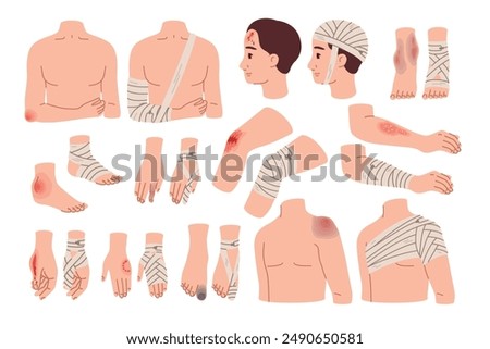 Applying bandages to wounds. Fixation and isolation of bruises. Bone fractures. Affected body parts. Physical injury. Emergency help. Hospital treatment. Plaster at knee