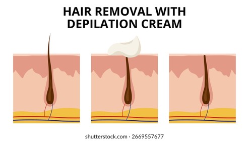 La aplicación de la crema de depilación en la piel disuelve el cabello en la superficie, mientras que una sección transversal revela el intrincado proceso de depilación, destacando varias capas y estructuras de la piel