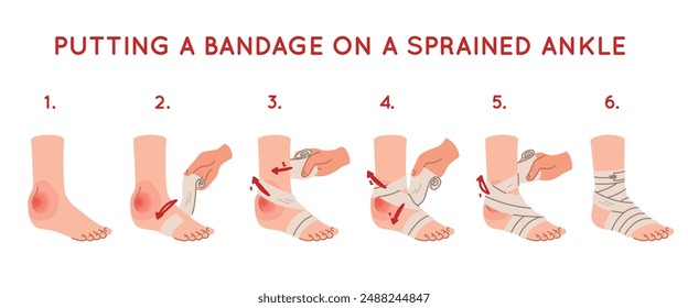 Anbringen einer elastischen Bandage am Knöchel. Fußverletzung. Weichteilschwellung. Medizinische Versorgung. Erste Hilfe. Schritt-für-Schritt-Anweisungen. Gebrochener Knochen. In: Trauma treatment manual. neulich