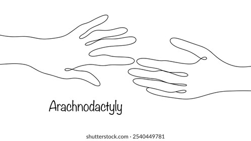 Aracnodactilia. A aparência especial dos dedos quando são alongados e têm uma curvatura peculiar. Linha desenhada mãos com aracnodactilia. Ilustração de vetor médico.