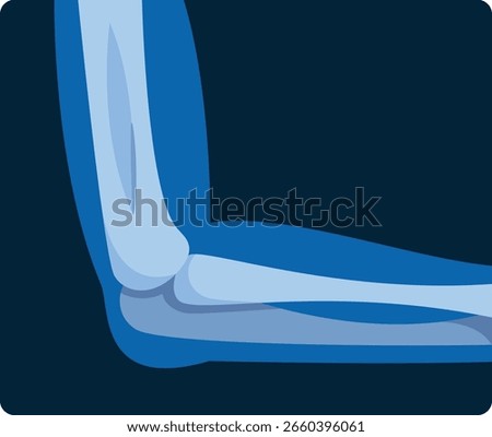 Arm elbow x-ray scan vector illustration