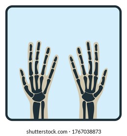 Arm Hand Knochen, Röntgen-Concept-Symbol, Röntgen-menschliches Körperbild einzeln auf Weiß, flache Vektorgrafik. Skelett Teil des menschlichen Organismus, Silhouette schwarze biologische Wissenschaft.