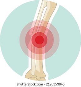 Arm joint with a red signal illustration