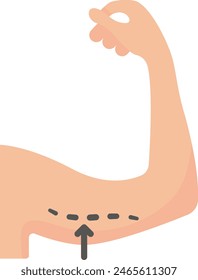 arm lift or Brachioplasty concept, Liposuction of the arms vector flat design, plastic surgeon Symbol, body contouring Sign, Beauty treatment stock illustration