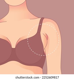 Armpit fat underarm wrinkled skin, Saggy skin removal. woman body shape transformation, Fat To Fit.  svg