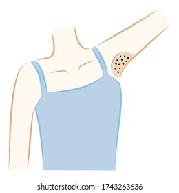 Armpits of women who are dark due to pigmentation and buried hair