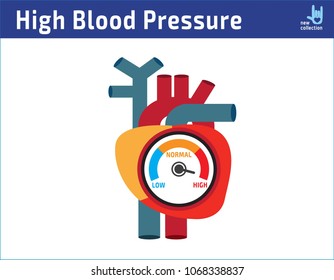 Arterial High Blood Pressure Checking Concept.
Vector Illustration Flat Icon Cartoon Design.
Medical Concept. Isolated On White Background.