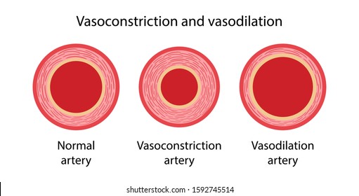 Arterial Vasoconstriction And Vasodilation. Comparison Illustration Of Normal, Constricted, And Dilated Blood Vessels. Diagram Of Cross Section Of Arteries. Vector Illustration