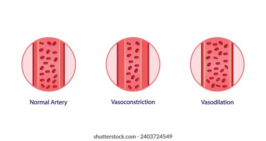 Arterial vasoconstriction and vasodilation. Cross section of arteries. Comparison of normal, constricted, and dilated blood vessels. Scientific Diagram. Vector illustration.