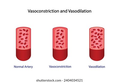Arterial vasoconstriction and vasodilation. Cross section of arteries. Comparison of normal, constricted, and dilated blood vessels. Scientific Diagram. Vector illustration.