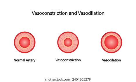 Arterial vasoconstriction and vasodilation. Cross section of arteries. Comparison of normal, constricted, and dilated blood vessels. Scientific Diagram. Vector illustration.