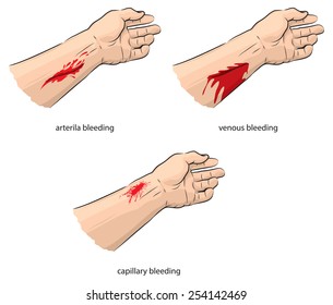 Hand Bleeding Images Stock Photos Vectors Shutterstock