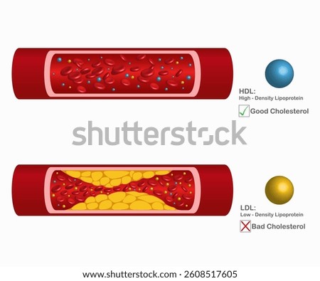 Arteries that are clogged with fat that causes blood clots are a leading cause of death. Types of cholesterol. High-density lipoprotein (HDL) and low-density lipoprotein (LDL). Vector illustration.