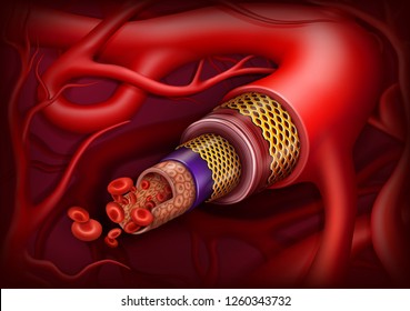Artery structure. Vector ilustration. Medical concept.