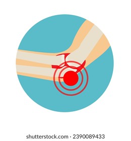 Arthritis or arthrosis of the elbow joint. Аnatomy of the elbow joint. Vector illustration in flat style.