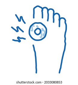 arthritis of bone on foot sketch icon vector. Hand drawn blue doodle line art arthritis of bone on foot sign. isolated symbol illustration