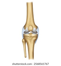 Arthritis - Bones -3d -Anatomy