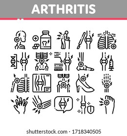 Arthritis Disease Collection Icons Set Vector. Arthritis Symptoms And Treatments, Pain In Joints And Back, Neck And Knee, Fingers And Ribs Concept Linear Pictograms. Monochrome Contour Illustrations