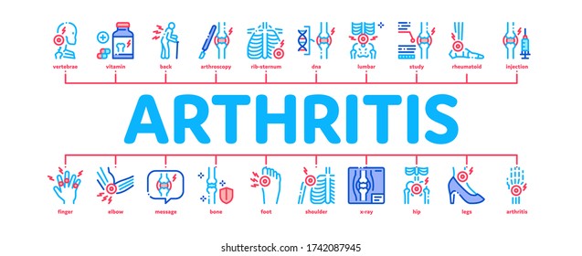 Arthritis Disease Minimal Infographic Web Banner Vector. Arthritis Symptoms And Treatments, Pain In Joints And Back, Neck And Knee, Fingers And Ribs Illustration