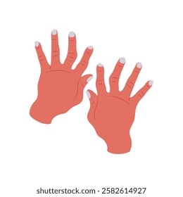 Arthritis, Hand, Disability Vector Illustration Isolated
