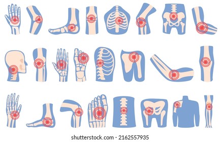 Iconos de artritis establecen el vector de dibujos animados. Daño conjunto. Ciencias médicas