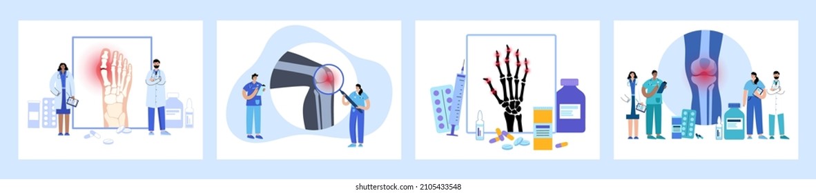 Arthritis joint in the ankle, knee and hand. Doctors appointment. Rheumatoid arthritis. Human bones anatomy flat vector illustration. Skeleton x ray scan. Painful injury and erosion. Pain in body
