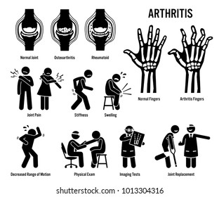 Arthritis, Joint Pain, and Joint Disease Icons. Pictograms depict arthritis signs, symptoms, diagnosis, and treatment. Icons include bones for osteoarthritis and rheumatoid arthritis.
