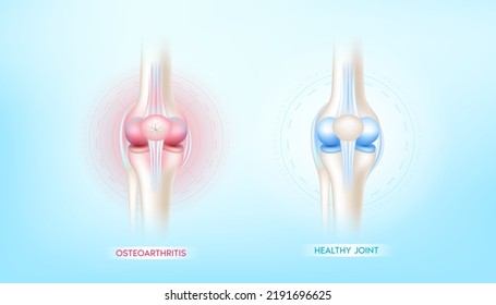 Gelenkschmerzen in Bein und Knochen gesund. Die Anatomie des menschlichen Knochens schädigt die Behandlung der Osteoarthritis. Skeletton-Röntgenabtastung Vektorgrafik EPS10.