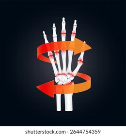 Artrite e osteoartrite. Seta giratória vermelha ao redor da inflamação da cartilagem articular do dedo do pulso no fundo escuro. Anatomia do esqueleto da mão humana. Para tratamentos médicos ou científicos de design. Vetor.