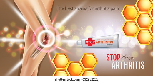 Arthritis Pain Relief Ointment Ads. Vector 3d Illustration With Tube Cream With Honey Extract. Horizontal Banner With Product's Package.