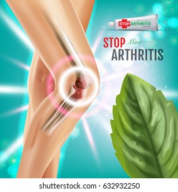 Arthritis Pain Relief Ointment ads. Vector 3d Illustration with Tube cream with peppermint extract. Vertical poster with product's package.