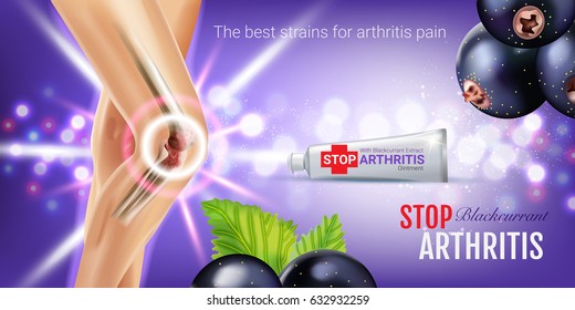 Arthritis Pain Relief Ointment Ads. Vector 3d Illustration With Tube Cream With Blackcurrant Extract. Horizontal Banner With Product's Package.