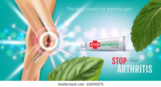 Arthritis Pain Relief Ointment Ads. Vector 3d Illustration With Tube Cream With Peppermint Extract. Horizontal With Product's Package.