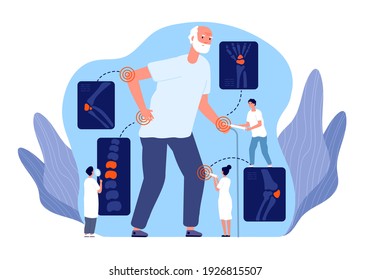 Arthritis. Rheumatoide Gelenke, Schmerzlinderung durch Patellaris bei Injektion. Knochen, Röntgenaufnahme, Knieschohl und Entzündung. Osteoporose-Krankheit