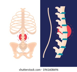 arthritis rheumatology spine anatomy science