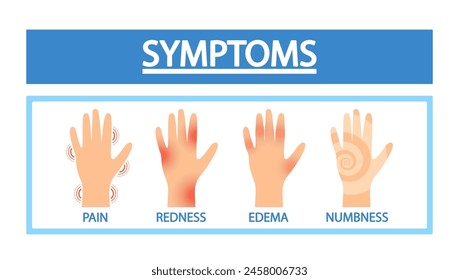 Síntomas De Artritis. Manos Enfermas Con Dolor Articular, Enrojecimiento, Edema O Entumecimiento. Afiche de infografía médica