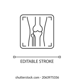 Arthritis x ray linear icon. Joint deformity depiction. Osteoarthritis diagnosis. Medical imaging. Thin line customizable illustration. Contour symbol. Vector isolated outline drawing. Editable stroke