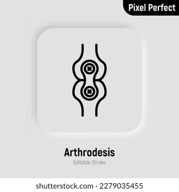 Arthrodesis joint surgery thin line icon. Arthritis. Pixel perfect, editable stroke. Vector illustration.
