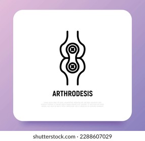 Arthrodesis joint surgery thin line icon. Arthritis. Vector illustration.