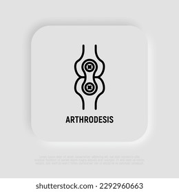 Arthrodesis joint surgery thin line icon. Arthritis. Vector illustration.